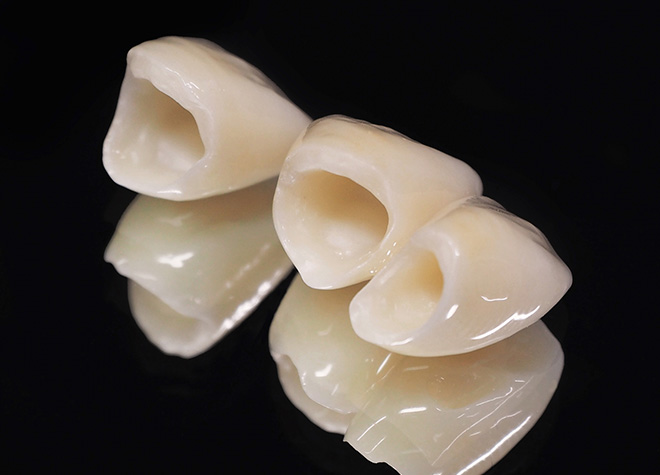 のざき歯科医院のオールセラミック