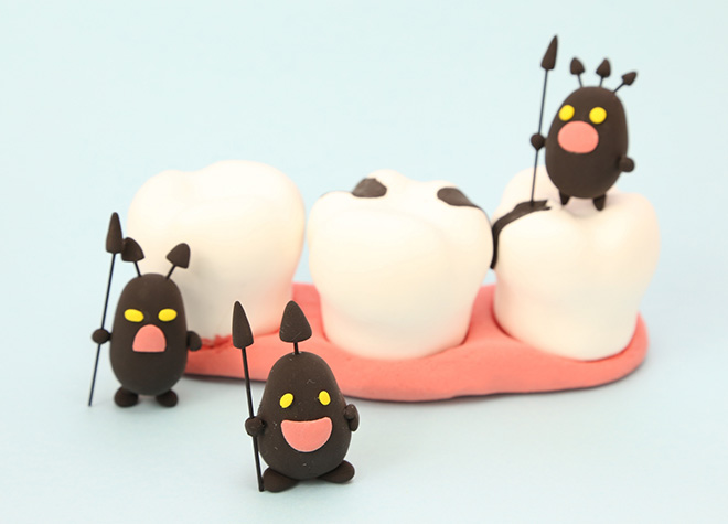 のざき歯科医院の虫歯予防